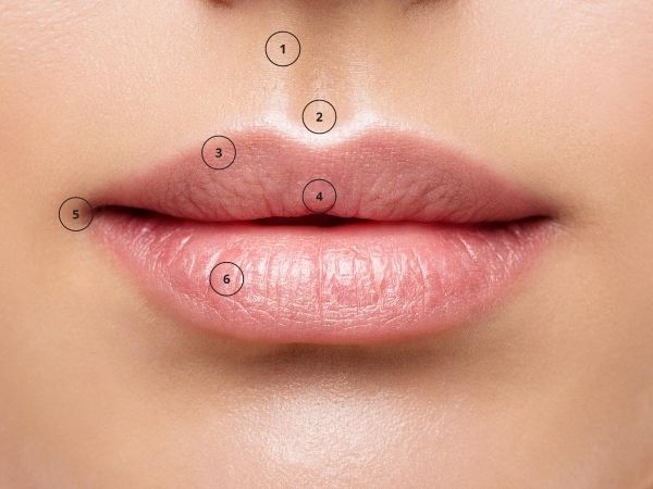 Lip fillers before and after